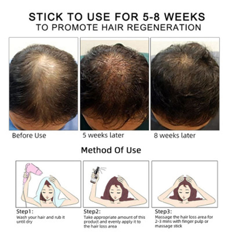 Hair Growth Oil Hair Care Essential Oil Hair Growth Oil Hair Care Essential Oil